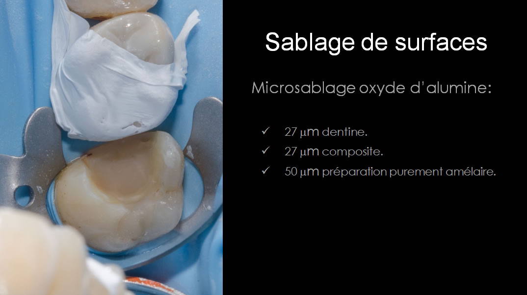 Lanoiselee-collage-08