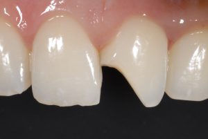 Figure 03_Marques_FZ_01