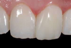 Figure 04_Marques_FZ_02-v2