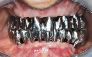 Empreintes scannées