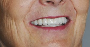 Challenge esthétique