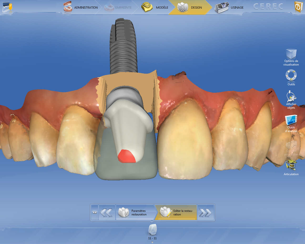 13a. Modélisation du pilier par réduction homothétique