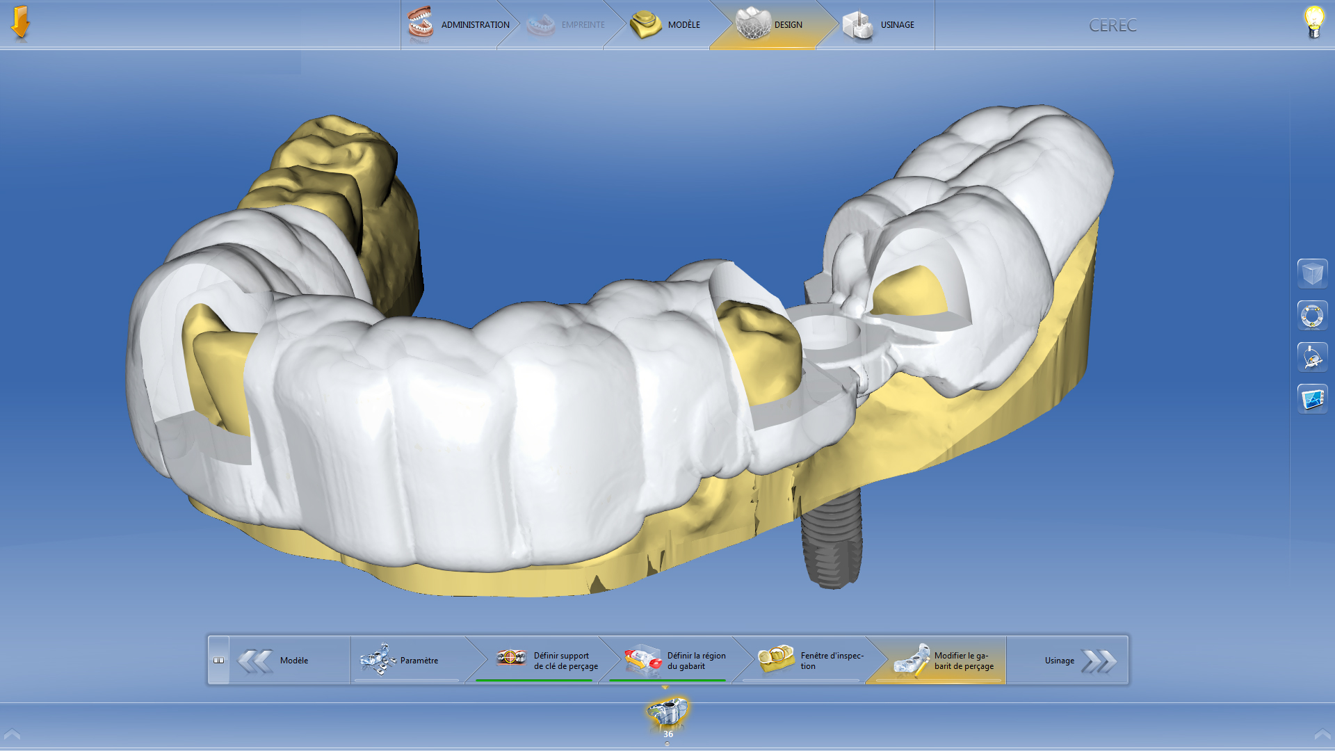 6. Modélisation d'un guide chirurgical