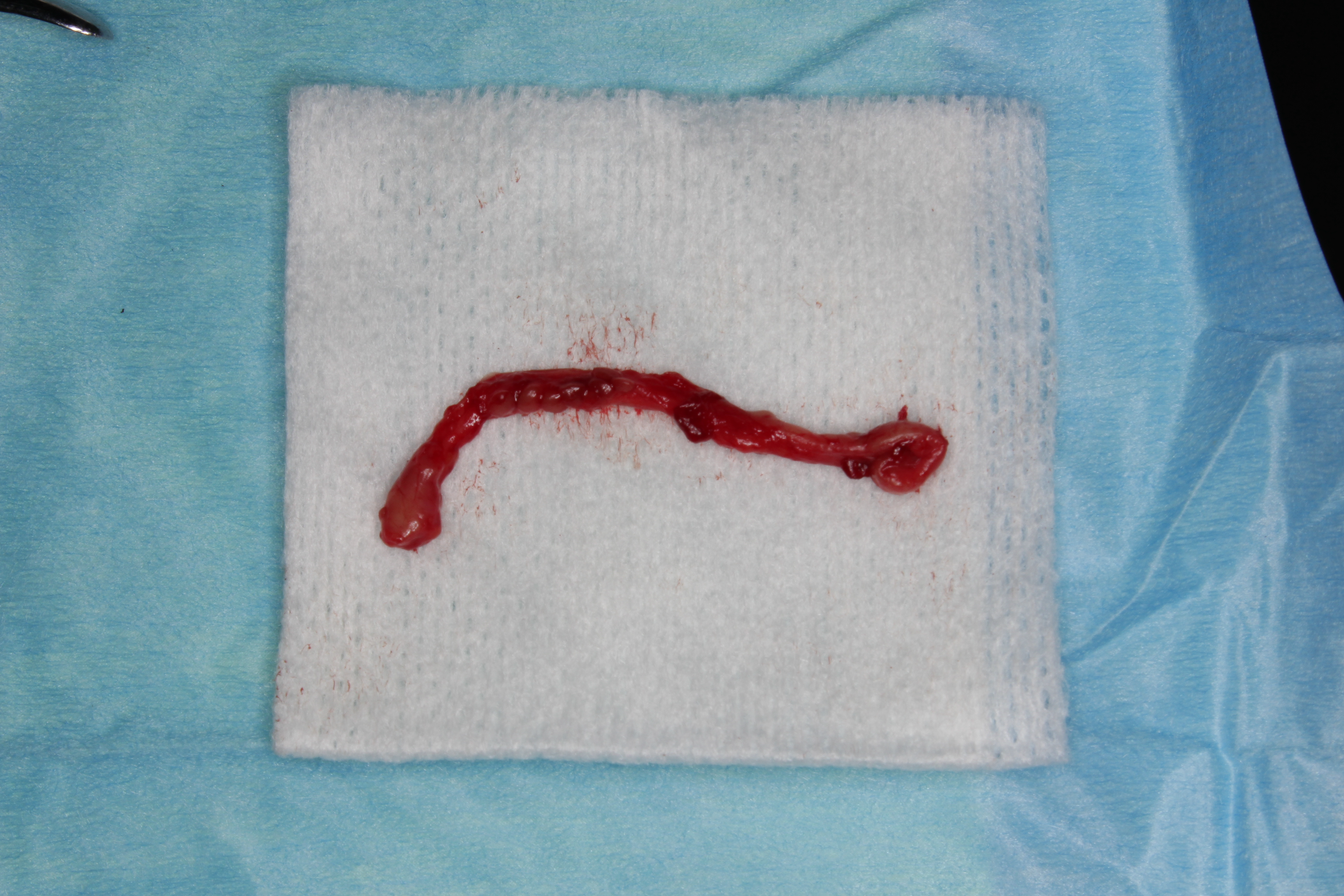 Fig. 9 : La bande épithéliale retirée