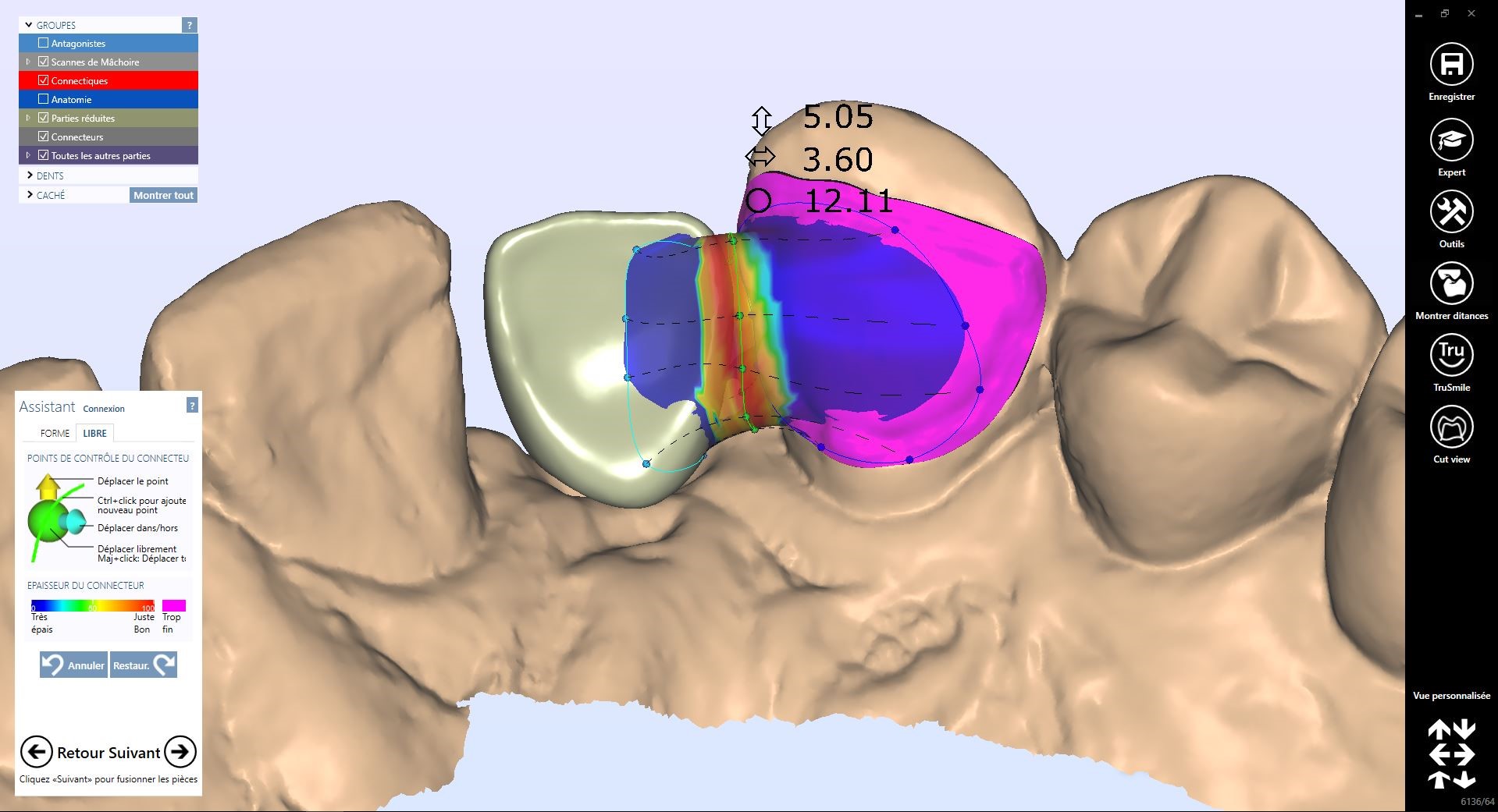 Contrôle de la connexion inter ailette sur l’armature : 12,11mm2 (source Digital Labs)