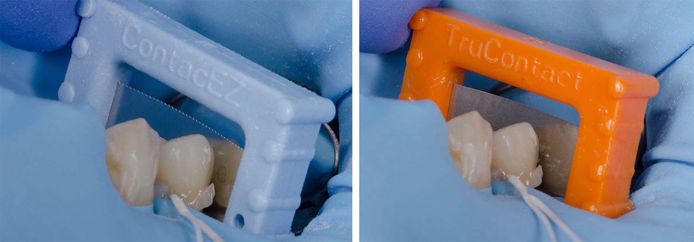 Scie pour séparer les points de contacts Strip abrasif pour polir le joint en proximal