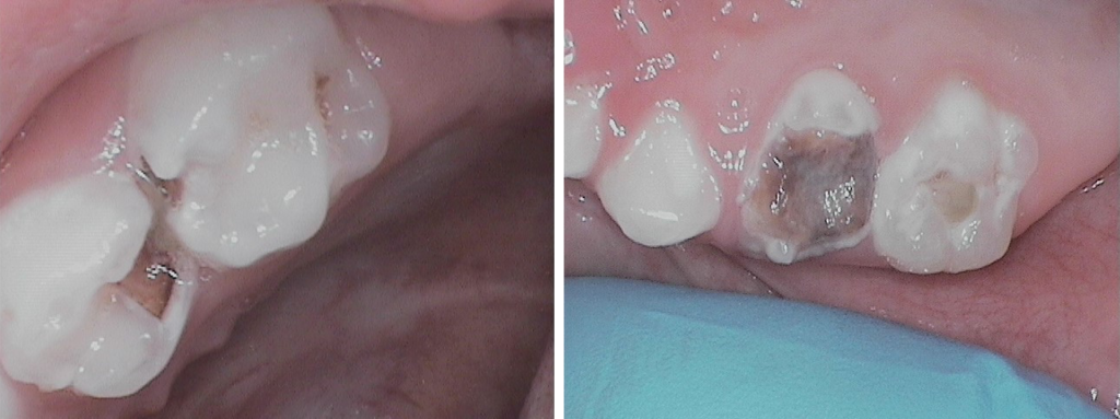 CPJE (garçon 3,5 ans)