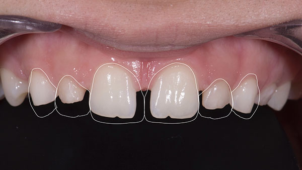 article-style-italiano.006