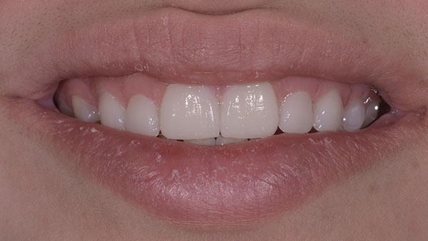 article-style-italiano.007