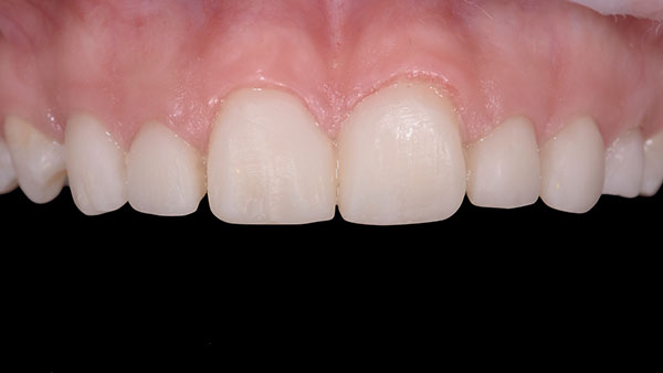 article-style-italiano.016