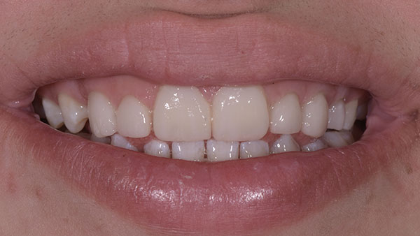 article-style-italiano.020