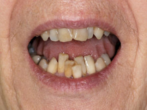 patient vieillissant