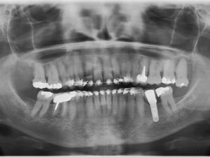 patient vieillissant