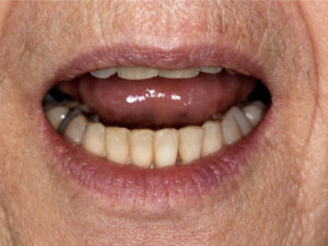 patient vieillissant