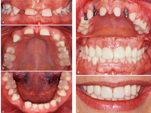 2-Dagmar Schnabl, Martin Brock, Wolfgang Puelacher.