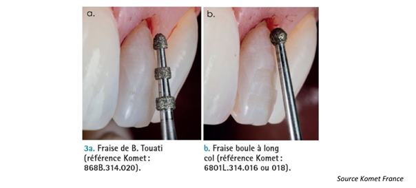 Outils d’aides aux préparations.