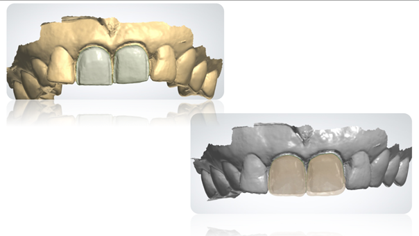 Modélisation des facettes (Digital Labs).