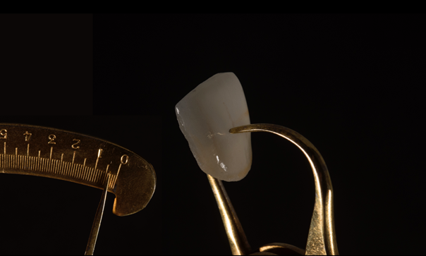 Une des facettes, épaisseur : 0,4mm.