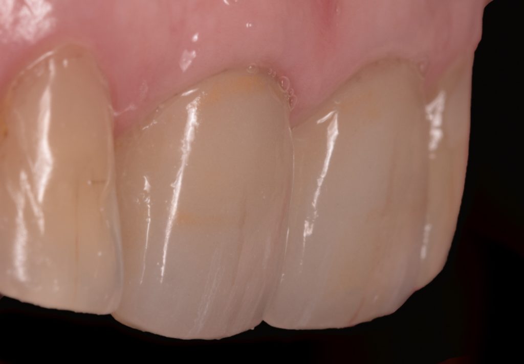 Vue de profil à 3 semaines.