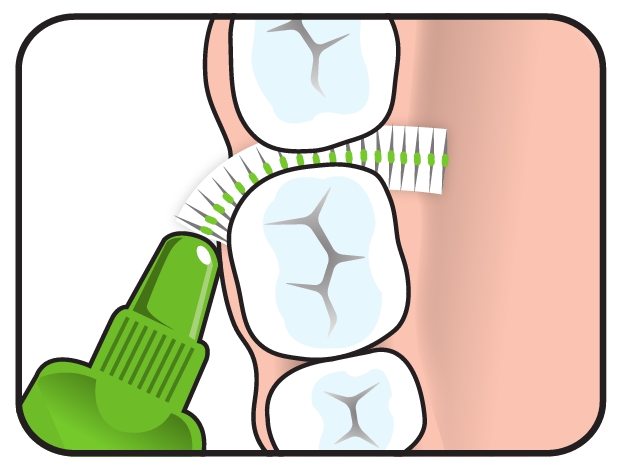 brossettes interdentaires