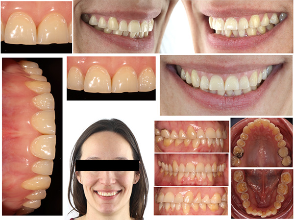 Fig 2 : Portfolio Photographique pour analyse du projet prothétique