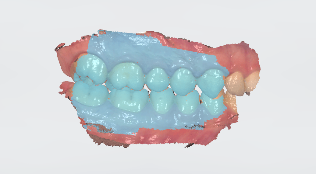 TRIOS Patient Specific Motion