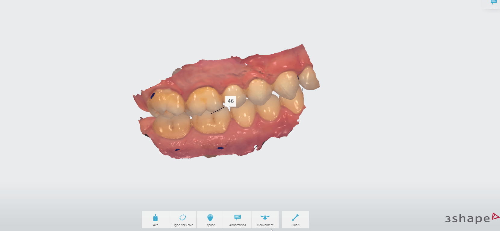  TRIOS Patient Specific Motion