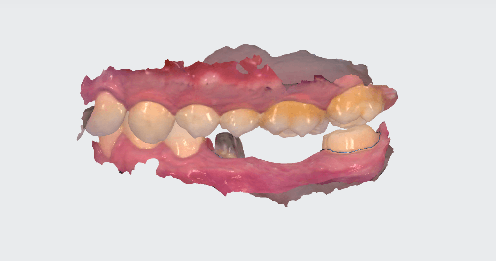 Enregistrement dynamique
