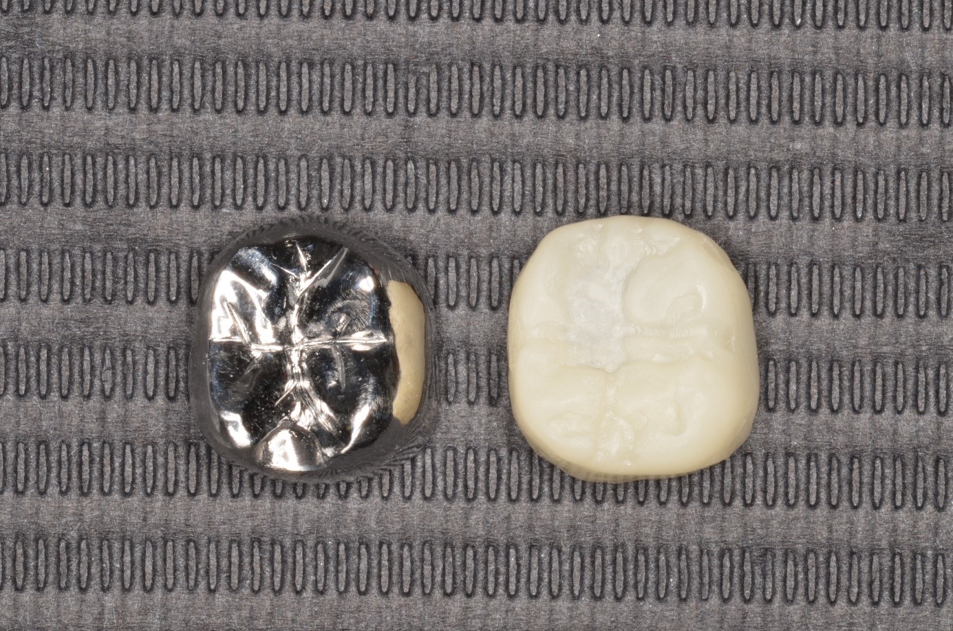 Vue 2 couronnes produites avec le Patient Specific Motion