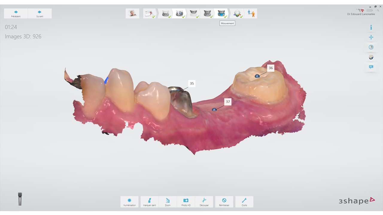 L’empreinte optique correspondante