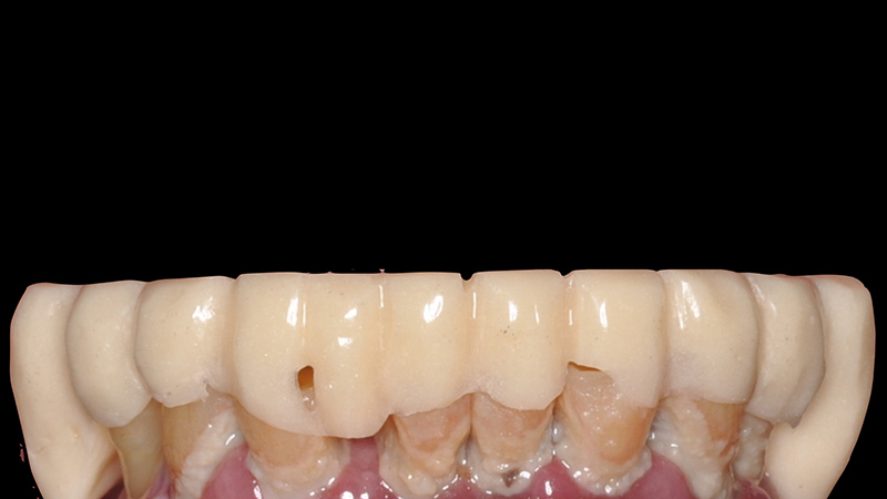 Courbe idéale à la mandibule