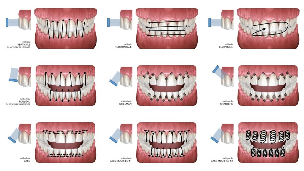 Principales techniques de brossage.