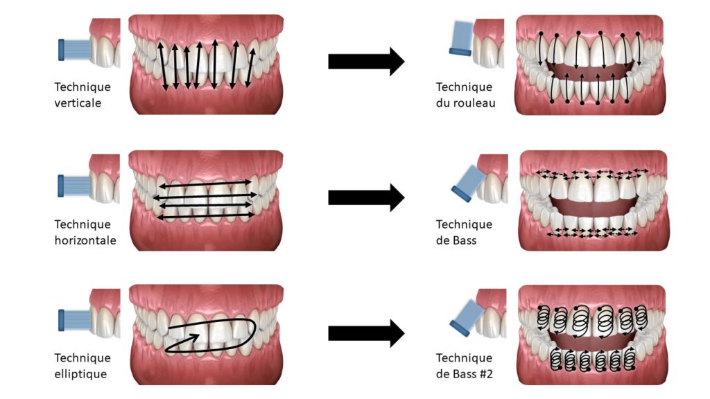 Adapter les techniques « naturelles » verticale, horizontale et elliptique.