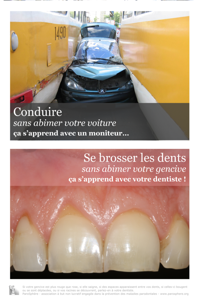 Le contrôle de plaque, c’est par où ? Par Frédéric Duffau