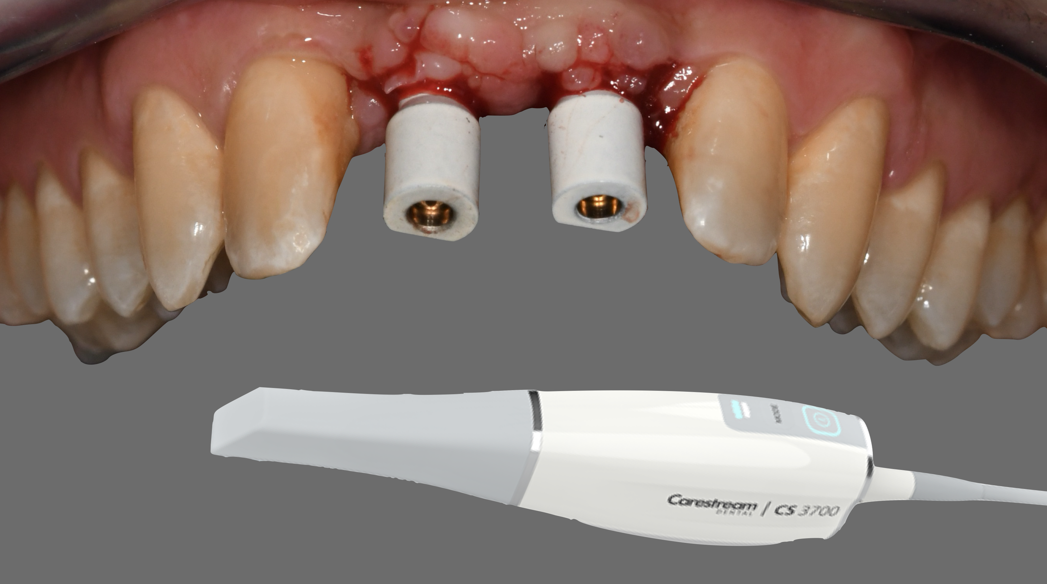 Capture d’écran 2019-12-03 à 23.01.59