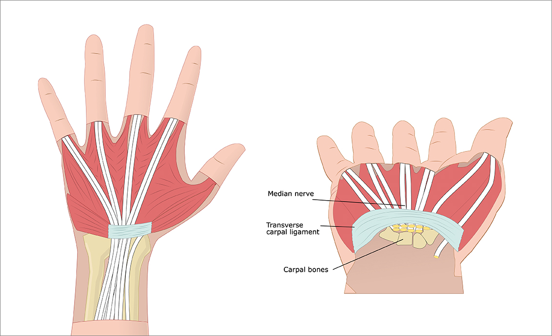 Carpal Tunnel Medical Illustration