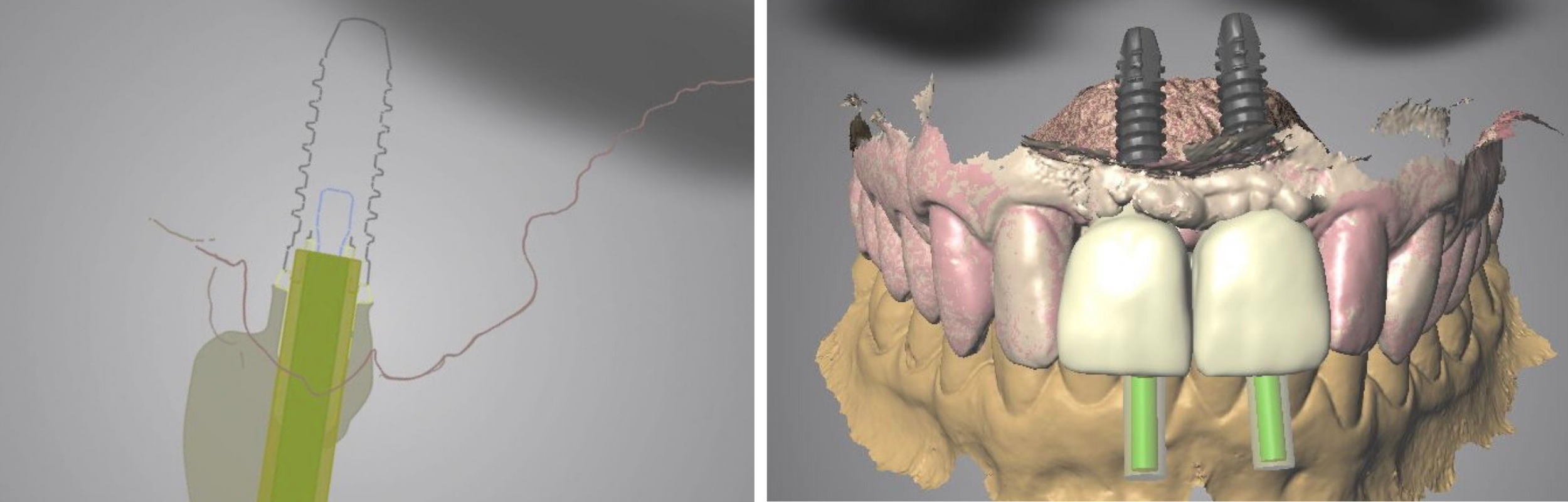 Le numérique au service de la clinique