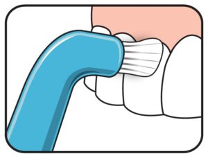 NETTOYAGE INTERDENTAIRE