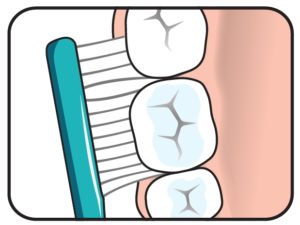 NETTOYAGE INTERDENTAIRE