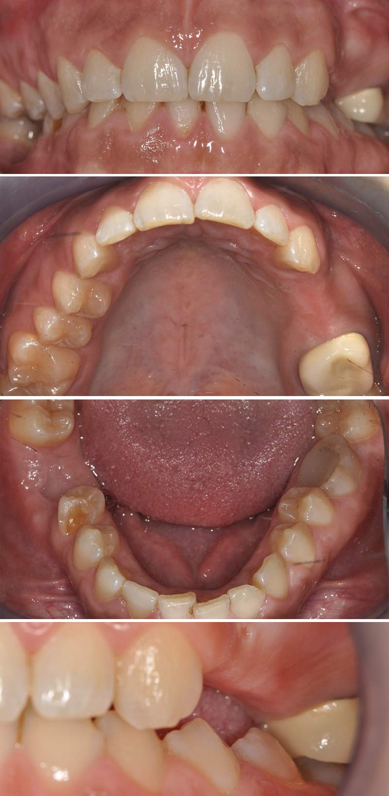 Situation clinique initiale
