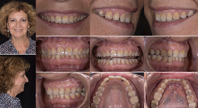 Analyse photographique