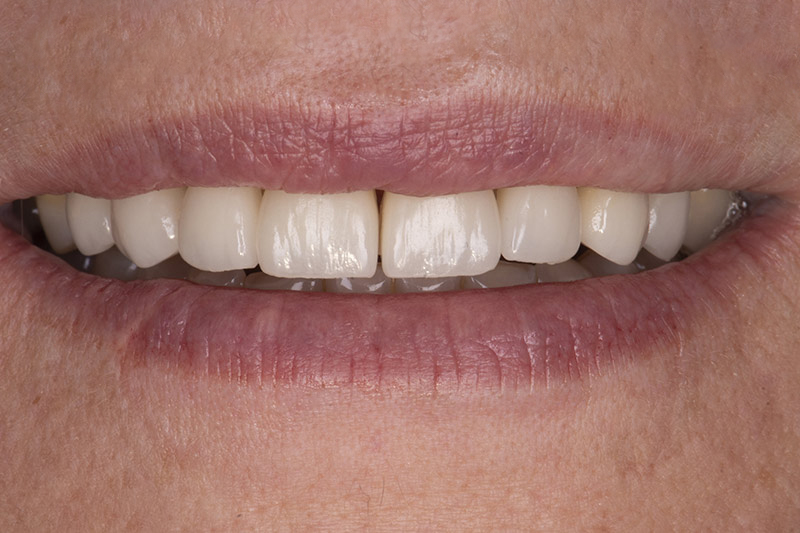 Essayage esthétique