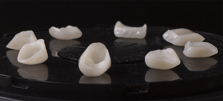 Restaurations déposée et stabilisée