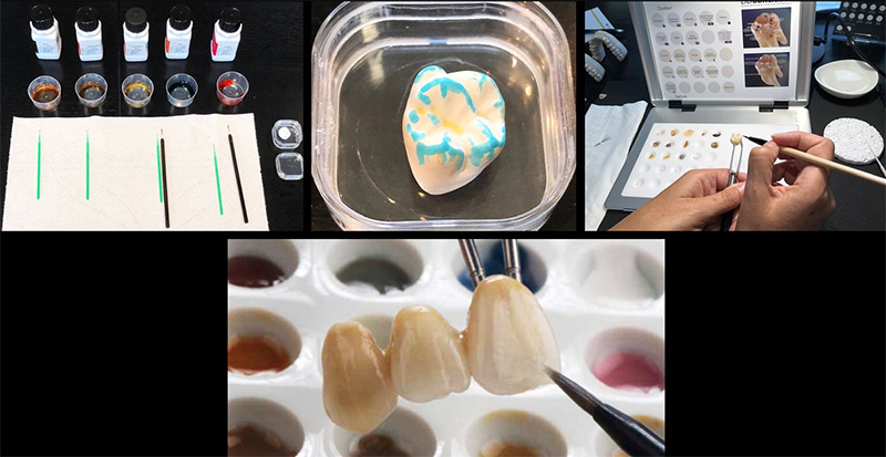 Infiltration de la Zircone