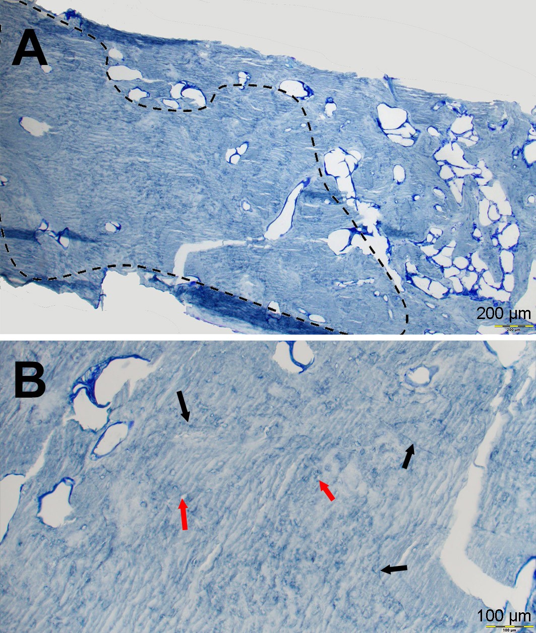 Figure-1-Mme-C_2eme-cas