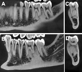 Figure-1a-Mme-C_2eme-cas