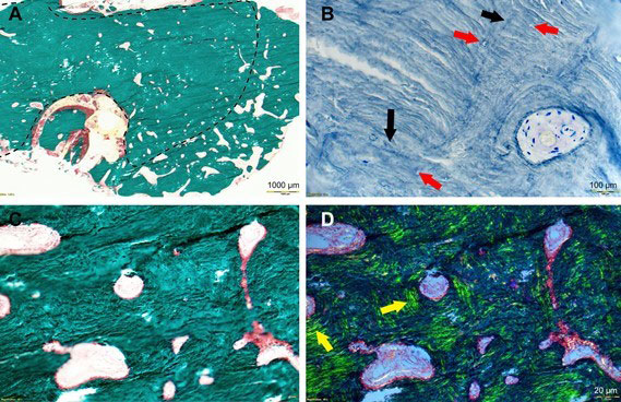 Figure-2-Mme-P_3eme-cas