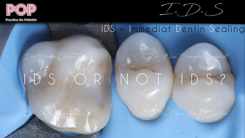 Figure article IDS POP.001