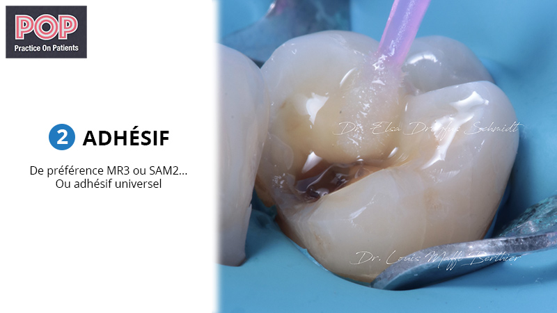 Figure article IDS POP.006