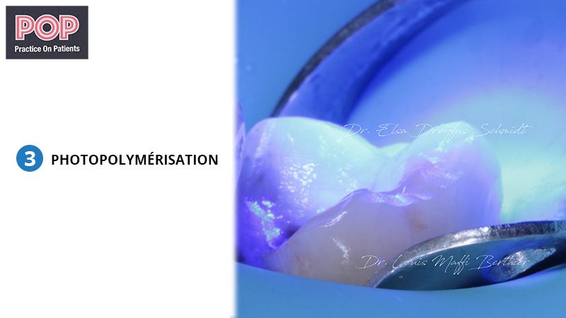 Figure article IDS POP.007